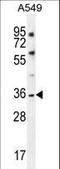 Potassium Two Pore Domain Channel Subfamily K Member 1 antibody, LS-C165437, Lifespan Biosciences, Western Blot image 