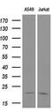 Cyclin Dependent Kinase Inhibitor 3 antibody, M05157, Boster Biological Technology, Western Blot image 