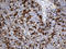 Junction Plakoglobin antibody, LS-C799933, Lifespan Biosciences, Immunohistochemistry paraffin image 