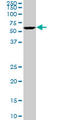 Ubiquitin Specific Peptidase 14 antibody, LS-C139458, Lifespan Biosciences, Western Blot image 