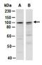Adenylate Cyclase 1 antibody, orb67118, Biorbyt, Western Blot image 