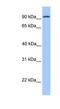 Cadherin 16 antibody, NBP1-59248, Novus Biologicals, Western Blot image 