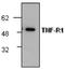 TNF Receptor Superfamily Member 1A antibody, GTX59625, GeneTex, Western Blot image 