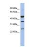 MAGE Family Member B3 antibody, NBP1-56934, Novus Biologicals, Western Blot image 
