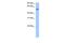 RNA Pseudouridine Synthase Domain Containing 2 antibody, GTX47210, GeneTex, Western Blot image 