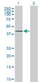 CMP-N-acetylneuraminate-beta-galactosamide-alpha-2,3-sialyltransferase 1 antibody, H00006482-D01P, Novus Biologicals, Western Blot image 