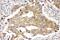 Prolactin Receptor antibody, PA2087, Boster Biological Technology, Immunohistochemistry frozen image 