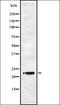 WAP Four-Disulfide Core Domain 2 antibody, orb337075, Biorbyt, Western Blot image 
