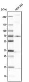 Meckel syndrome type 1 protein antibody, NBP1-88691, Novus Biologicals, Western Blot image 