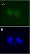 Aurora Kinase A antibody, LS-B3912, Lifespan Biosciences, Immunofluorescence image 