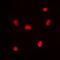 Ring Finger Protein 8 antibody, orb341268, Biorbyt, Immunofluorescence image 