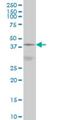 DnaJ Heat Shock Protein Family (Hsp40) Member B5 antibody, H00025822-M01, Novus Biologicals, Western Blot image 