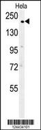 Clathrin Heavy Chain antibody, MBS9210363, MyBioSource, Western Blot image 