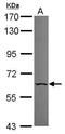 Bifunctional polynucleotide phosphatase/kinase antibody, GTX108569, GeneTex, Western Blot image 