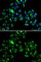 Caspase Recruitment Domain Family Member 11 antibody, GTX55548, GeneTex, Immunocytochemistry image 