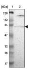 Protein Kinase C Delta antibody, NBP1-90957, Novus Biologicals, Western Blot image 