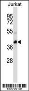 Potassium Channel Tetramerization Domain Containing 10 antibody, 57-028, ProSci, Western Blot image 