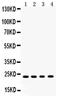 Retinol Binding Protein 4 antibody, PA5-79920, Invitrogen Antibodies, Western Blot image 