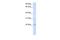 Transmembrane Protein 9 antibody, PA5-43004, Invitrogen Antibodies, Western Blot image 