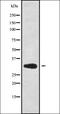 OTU Deubiquitinase, Ubiquitin Aldehyde Binding 1 antibody, orb338794, Biorbyt, Western Blot image 