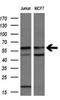 Natriuretic Peptide Receptor 3 antibody, M03589-3, Boster Biological Technology, Western Blot image 