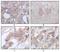Serine/Threonine/Tyrosine Kinase 1 antibody, GTX83202, GeneTex, Immunohistochemistry paraffin image 