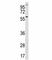 ETS Variant 5 antibody, F47670-0.4ML, NSJ Bioreagents, Western Blot image 