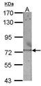 RecQ Like Helicase antibody, GTX100085, GeneTex, Western Blot image 