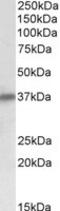 Sarcoglycan Delta antibody, LS-B8353, Lifespan Biosciences, Western Blot image 
