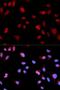 ABL Proto-Oncogene 1, Non-Receptor Tyrosine Kinase antibody, LS-C335712, Lifespan Biosciences, Immunofluorescence image 