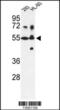Cytochrome P450 Family 21 Subfamily A Member 2 antibody, 63-263, ProSci, Western Blot image 