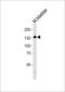 Myosin light chain kinase, smooth muscle antibody, LS-C98724, Lifespan Biosciences, Western Blot image 