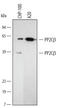 Protein Phosphatase, Mg2+/Mn2+ Dependent 1B antibody, AF4396, R&D Systems, Western Blot image 