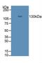 Desmoglein 3 antibody, MBS2003582, MyBioSource, Western Blot image 