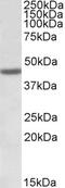 Rho GDP Dissociation Inhibitor Gamma antibody, 42-820, ProSci, Western Blot image 