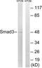 SMAD Family Member 3 antibody, LS-C117930, Lifespan Biosciences, Western Blot image 