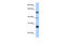 MAX Dimerization Protein 3 antibody, 29-102, ProSci, Western Blot image 