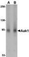 AP2 Associated Kinase 1 antibody, A05368-1, Boster Biological Technology, Western Blot image 