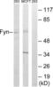 FYN Proto-Oncogene, Src Family Tyrosine Kinase antibody, LS-C117608, Lifespan Biosciences, Western Blot image 