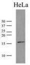 Small Ubiquitin Like Modifier 2 antibody, GTX50000, GeneTex, Western Blot image 