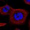 Tetratricopeptide Repeat Domain 39A antibody, PA5-65358, Invitrogen Antibodies, Immunofluorescence image 