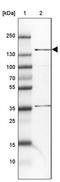 ATP Binding Cassette Subfamily B Member 11 antibody, PA5-53899, Invitrogen Antibodies, Western Blot image 