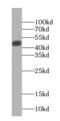 Interleukin 36 Beta antibody, FNab04241, FineTest, Western Blot image 