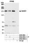 SAM And SH3 Domain Containing 1 antibody, A302-265A, Bethyl Labs, Immunoprecipitation image 