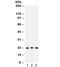 Peroxiredoxin 5 antibody, R32051, NSJ Bioreagents, Western Blot image 