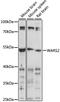 Tryptophanyl TRNA Synthetase 2, Mitochondrial antibody, LS-C750358, Lifespan Biosciences, Western Blot image 