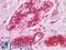 Interleukin 3 Receptor Subunit Alpha antibody, LS-A13076, Lifespan Biosciences, Immunohistochemistry paraffin image 