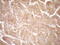 Erb-B2 Receptor Tyrosine Kinase 3 antibody, M00539-2, Boster Biological Technology, Immunohistochemistry paraffin image 