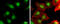 Cyclin Dependent Kinase Inhibitor 1B antibody, GTX100446, GeneTex, Immunocytochemistry image 