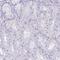 Keratin 78 antibody, NBP1-93671, Novus Biologicals, Immunohistochemistry paraffin image 
